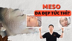 Tiêm Meso Là Gì? Tất Tần Tật Về Trào Lưu Làm Đẹp Da “Thần Kỳ” Dưới Góc Nhìn Bác Sĩ Da Liễu