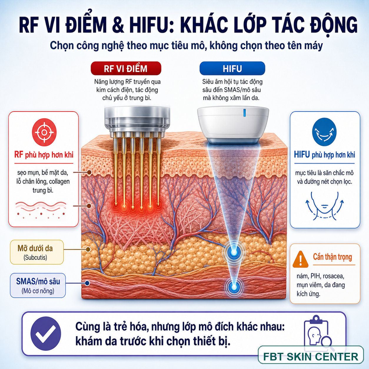 RF microneedling tác động vào lớp nào? Kim, RF, trung bì và collagen.