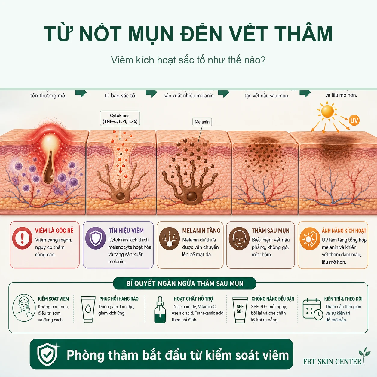 Infographic từ nốt mụn đến vết thâm