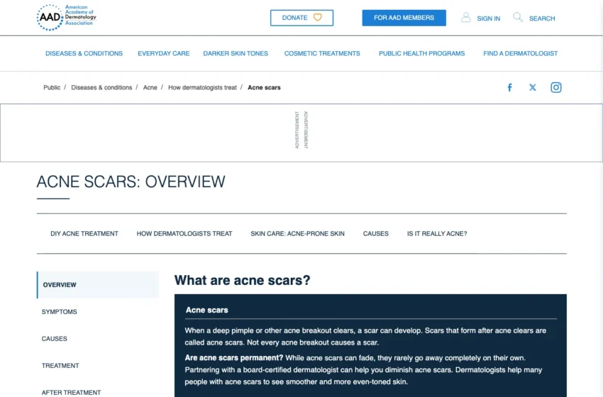 Screenshot nguồn AAD về sẹo mụn