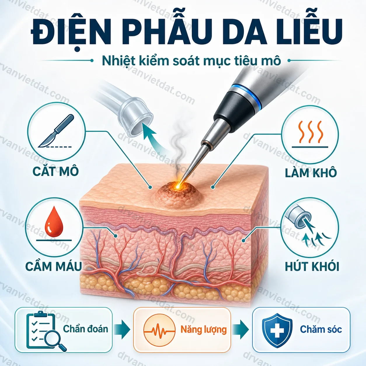 Infographic nguyên lý điện phẫu da liễu