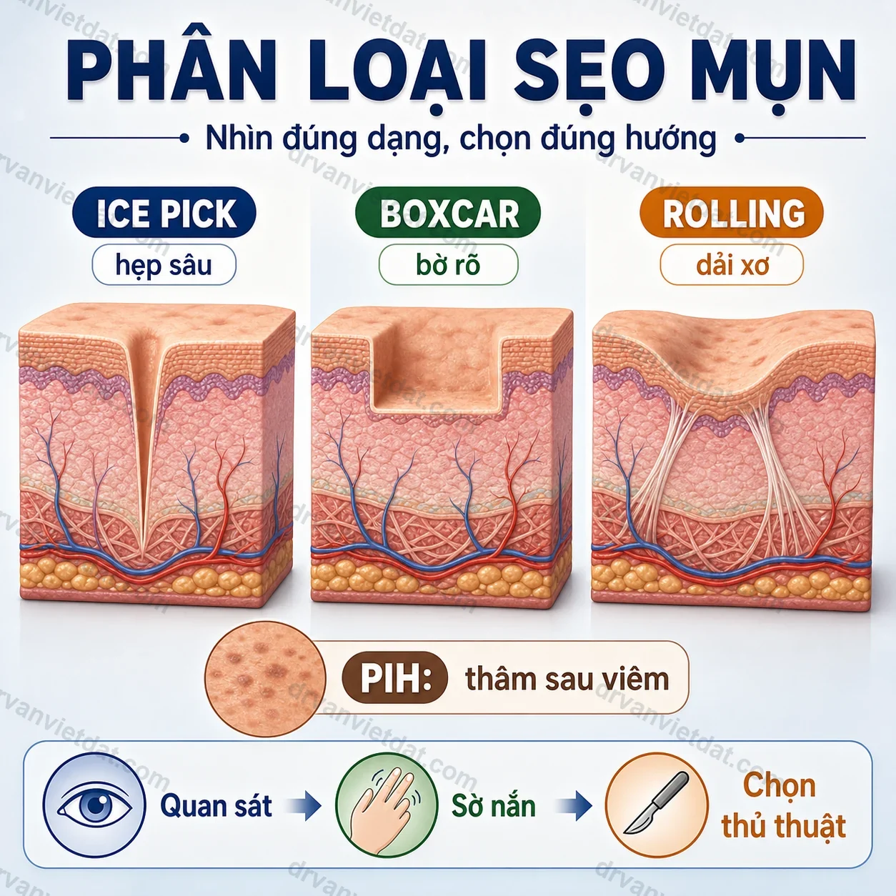 Infographic phân loại sẹo mụn