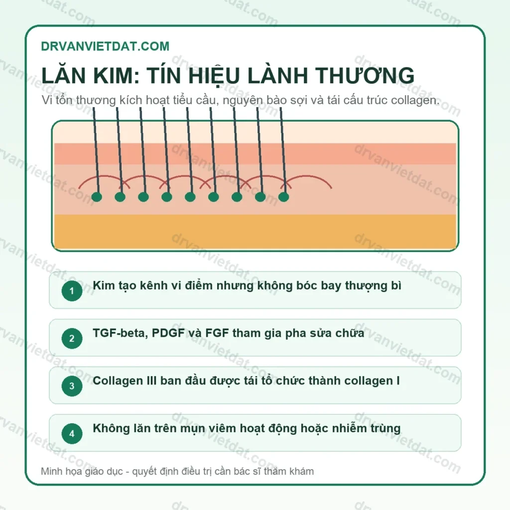 Infographic cơ chế collagen sau lăn kim