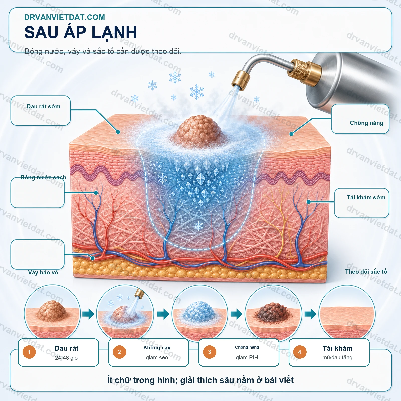 Cryotherapy 2: Áp lạnh trong da liễu thẩm mỹ - kiểm soát độ sâu và lựa chọn tổn thương