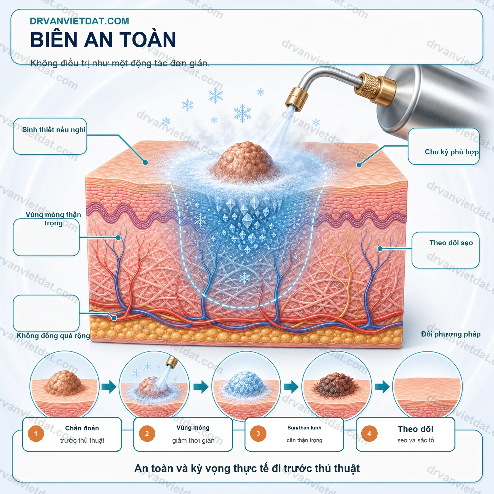 Cryotherapy 2: Áp lạnh trong da liễu thẩm mỹ - kiểm soát độ sâu và lựa chọn tổn thương
