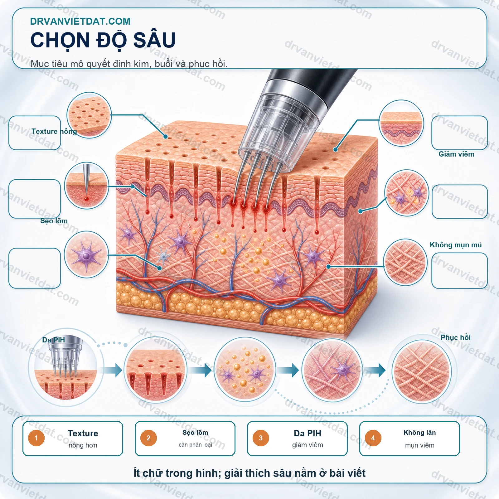 Lăn kim 2: Lăn kim vi điểm và tái tạo collagen - chọn độ sâu, khoảng cách và chỉ định