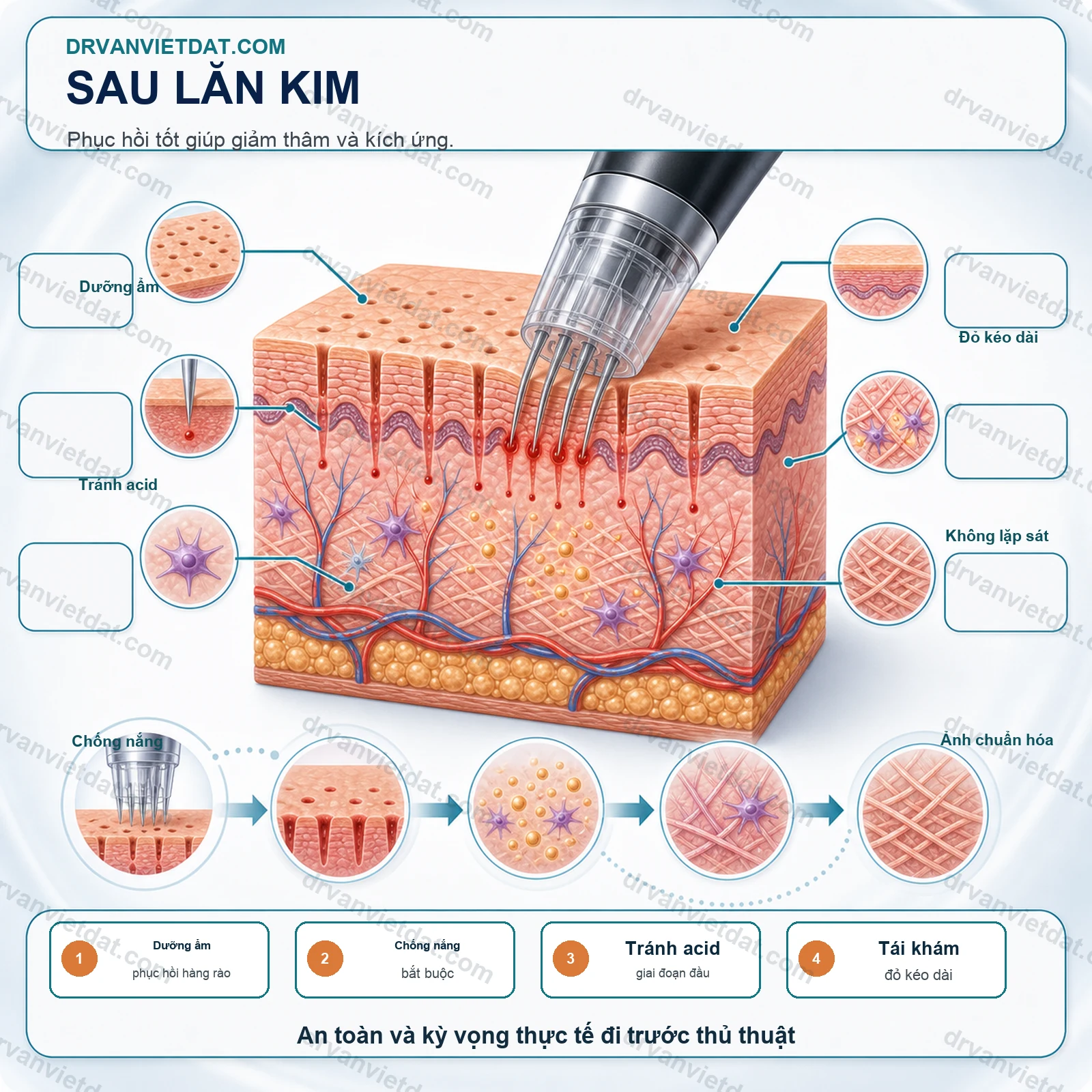 Lăn kim 2: Lăn kim vi điểm và tái tạo collagen - chọn độ sâu, khoảng cách và chỉ định