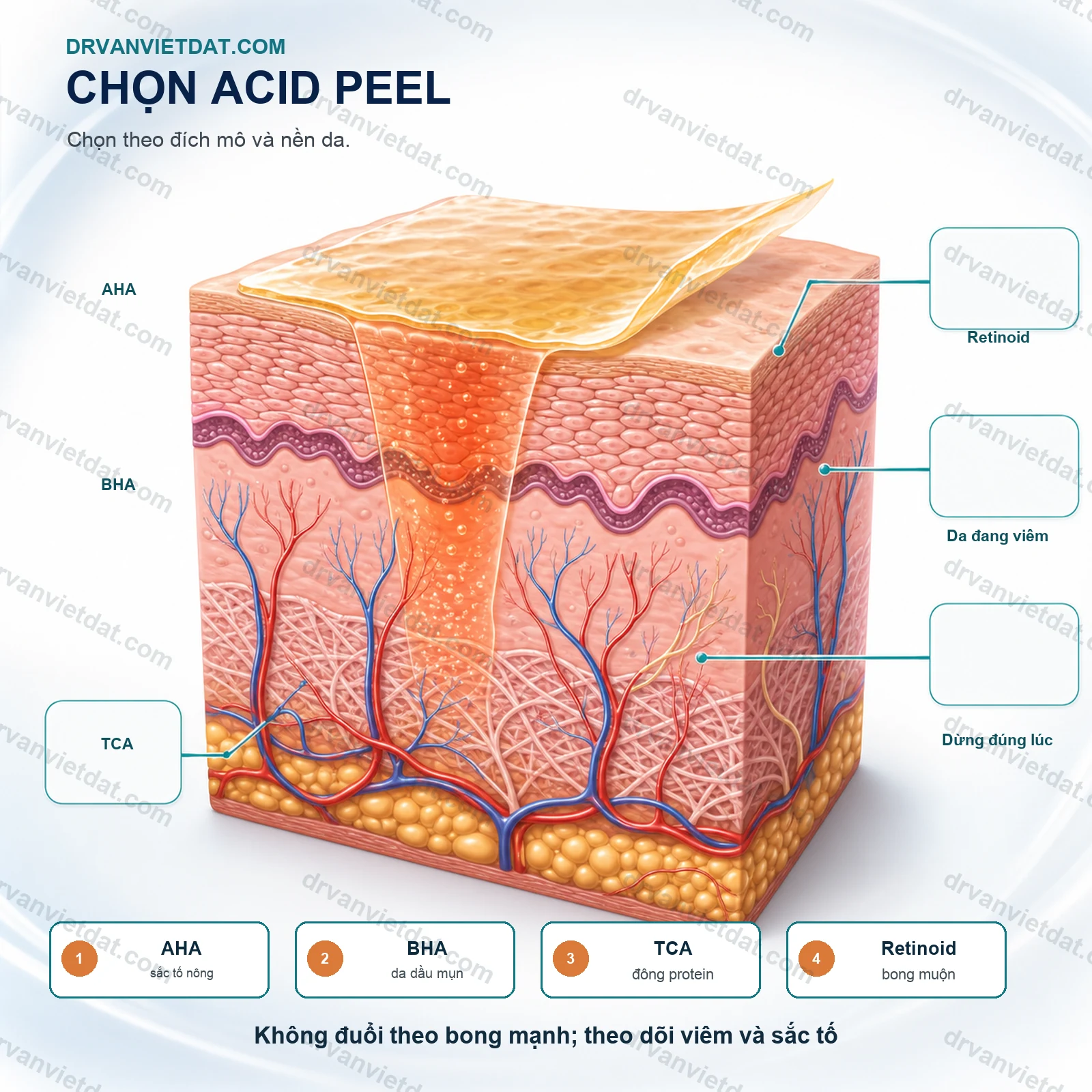 Peel nông 3: Chọn bệnh nhân và chuẩn bị da trước thủ thuật