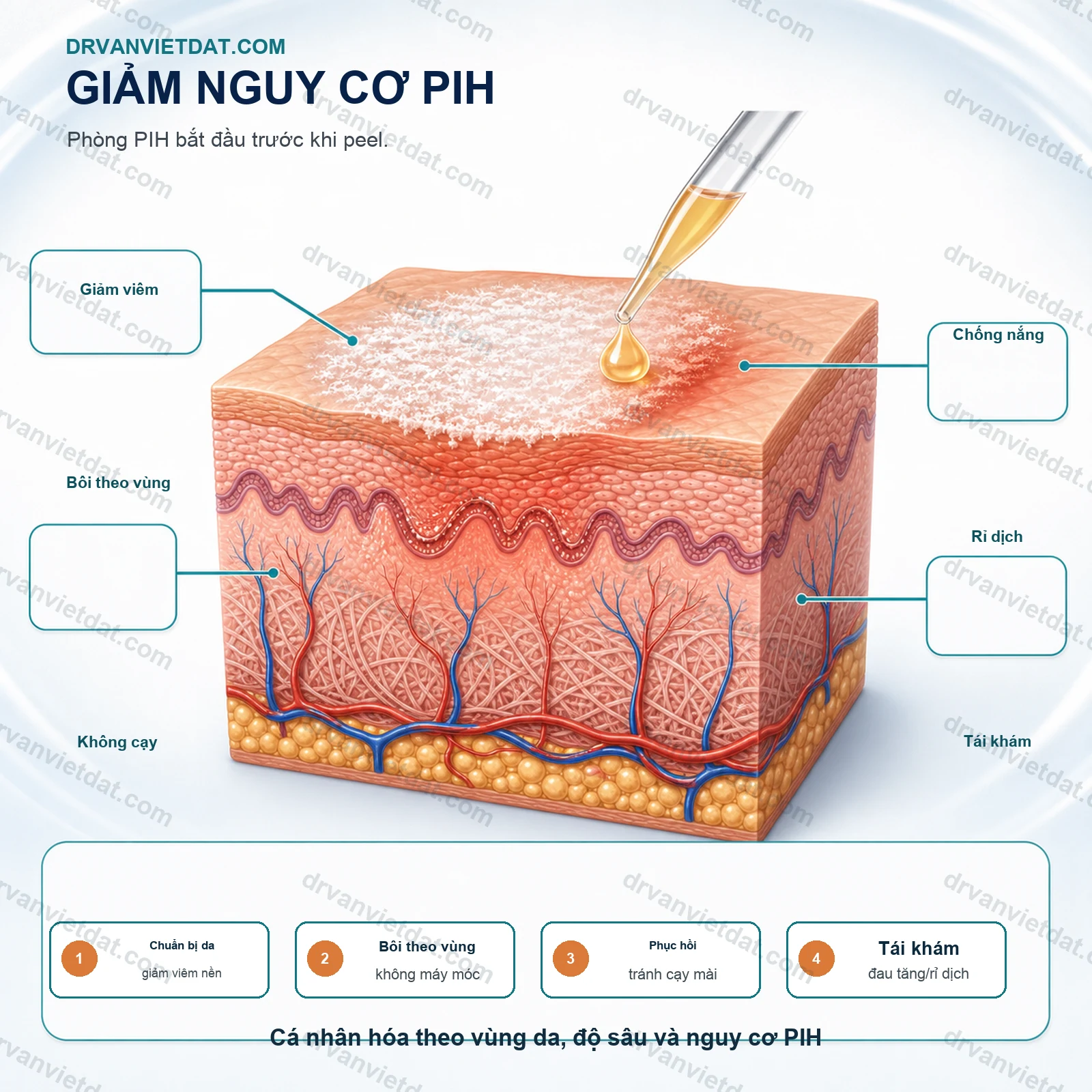 Phối hợp peel TCA 2: Kiểm soát độ sâu và giảm nguy cơ thâm sau viêm - thực hành