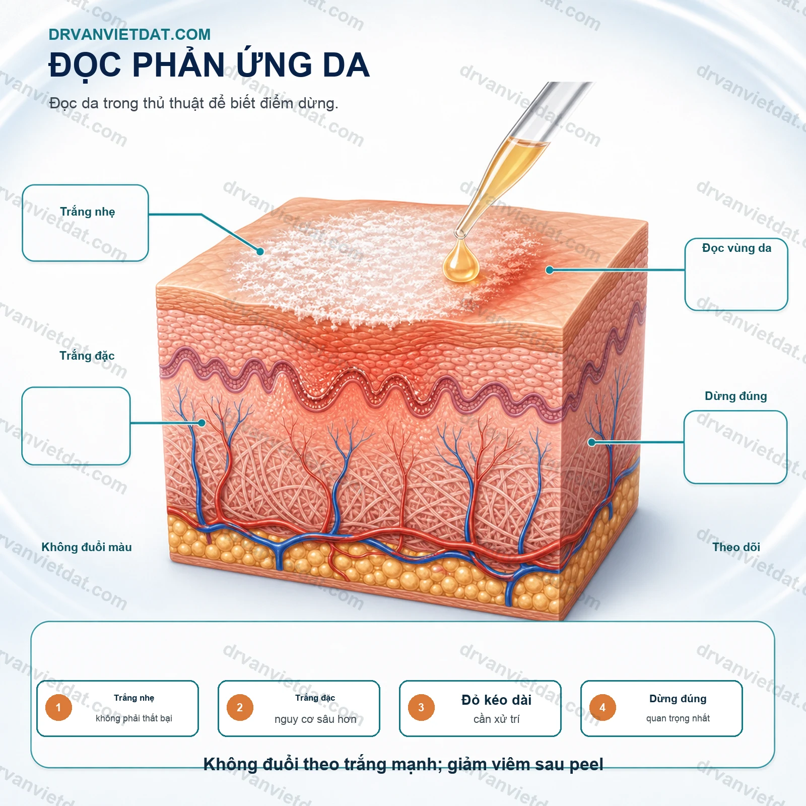 TCA peel 2: Chỉ định, chống chỉ định và phục hồi sau thủ thuật - cơ chế