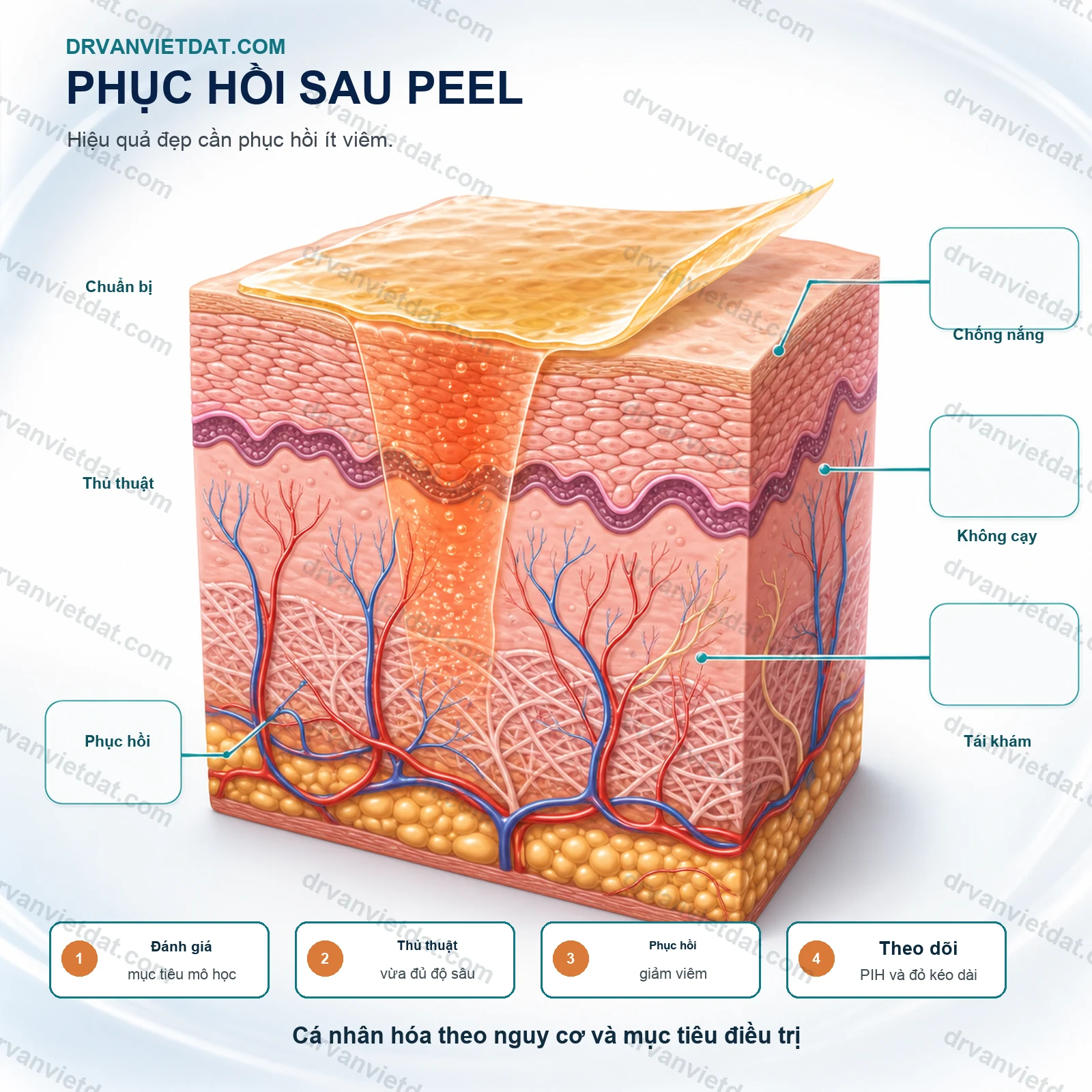 Salicylic acid peel 2: Chỉ định, chống chỉ định và phối hợp thuốc bôi mụn - thực hành