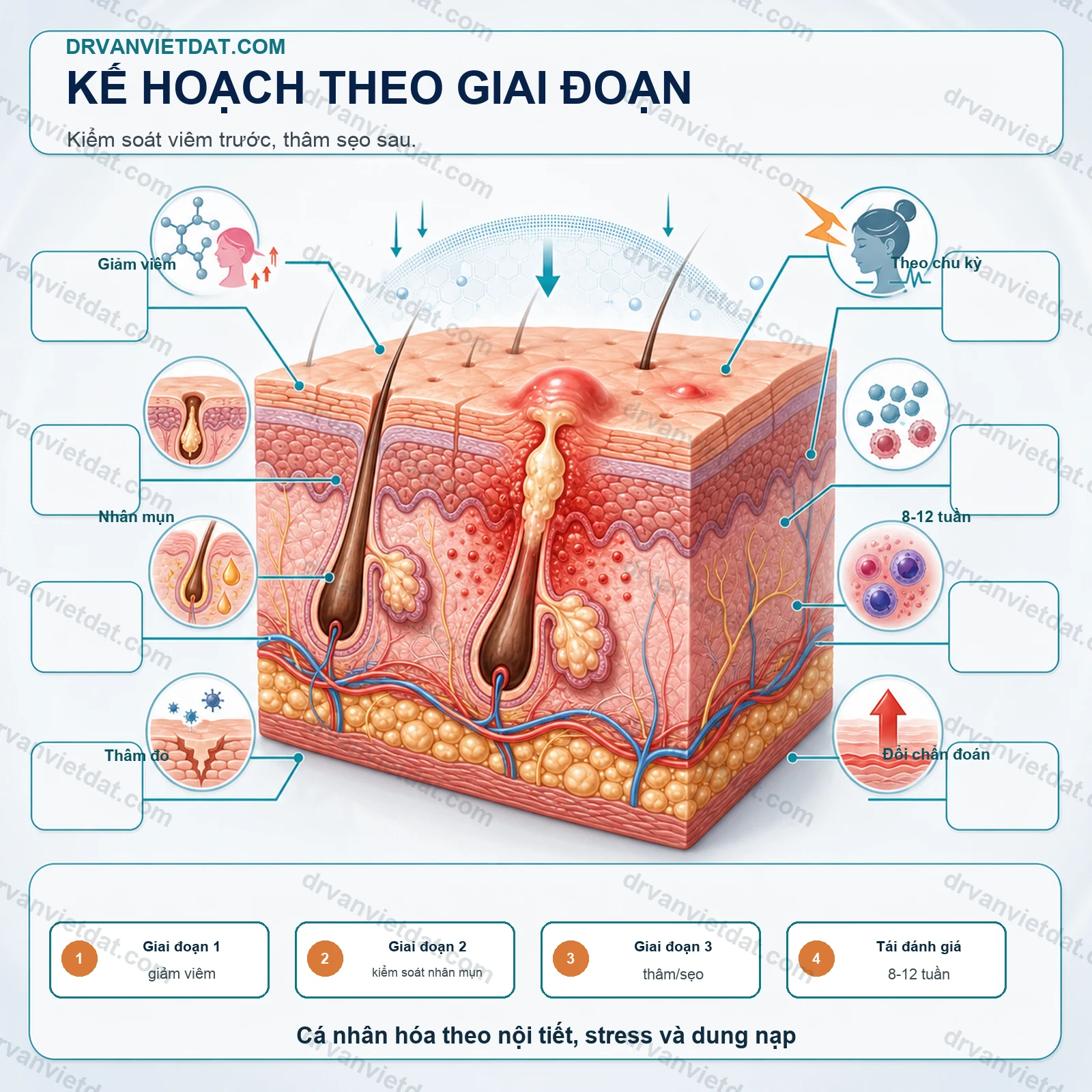 Mụn phụ nữ trưởng thành 1: Vai trò nội tiết, stress và hàng rào da - thực hành