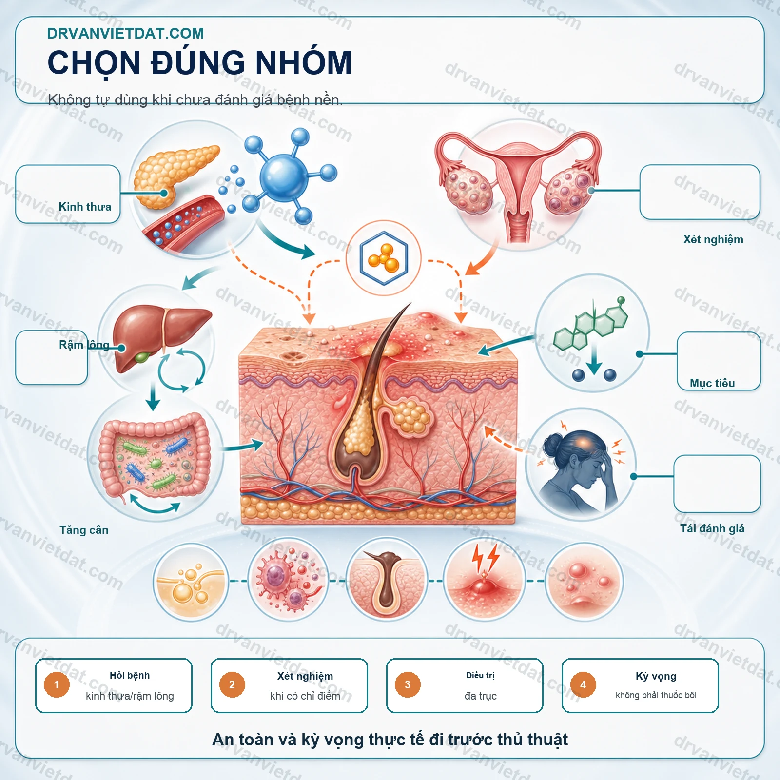 Metformin và mụn trứng cá: vai trò chuyển hóa trong một số nhóm bệnh nhân - thực hành