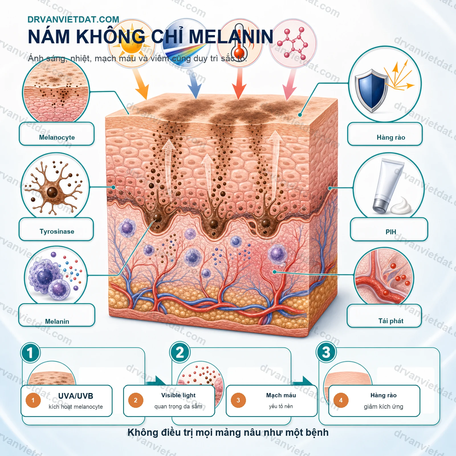Methimazole bôi trong nám: hoạt chất tiềm năng nhưng cần hiểu đúng bằng chứng