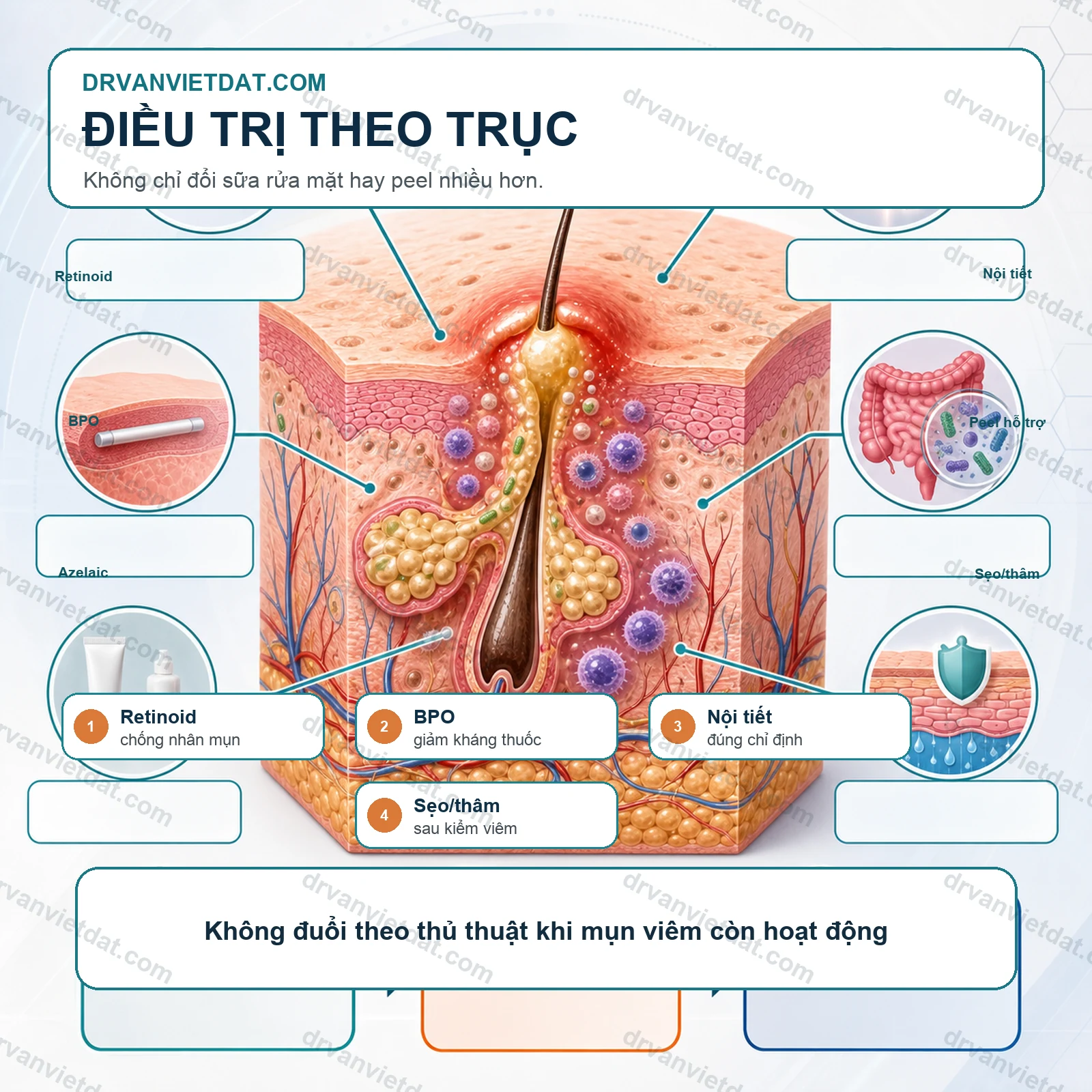 Mụn ở phụ nữ trưởng thành: vai trò nội tiết, stress và chăm sóc da (phần nền tảng)