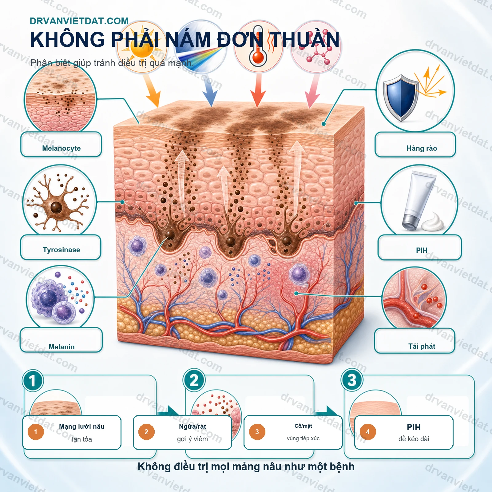 Riehl melanosis: tăng sắc tố do tiếp xúc và cách tiếp cận thận trọng