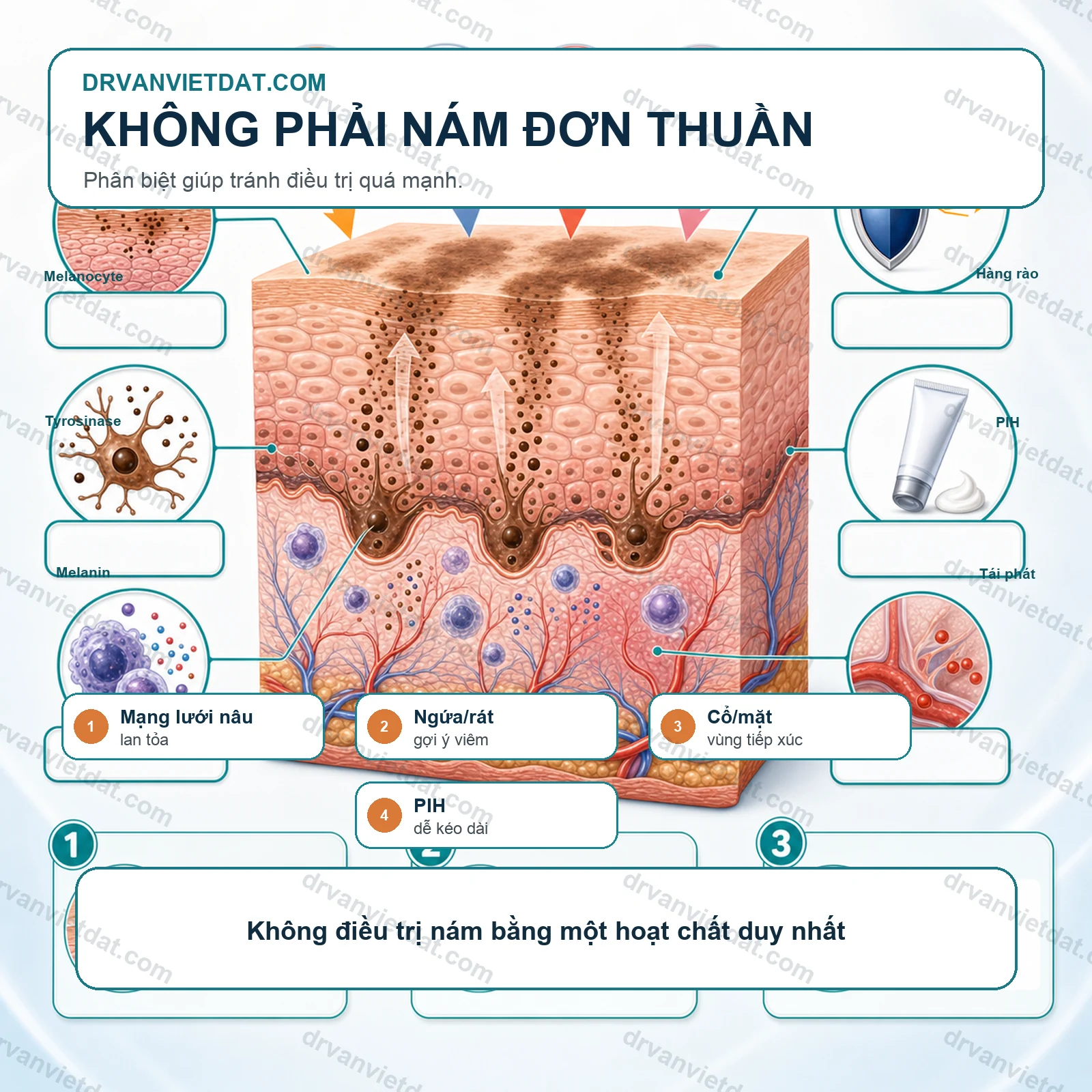Riehl melanosis: tăng sắc tố do tiếp xúc và cách tiếp cận thận trọng