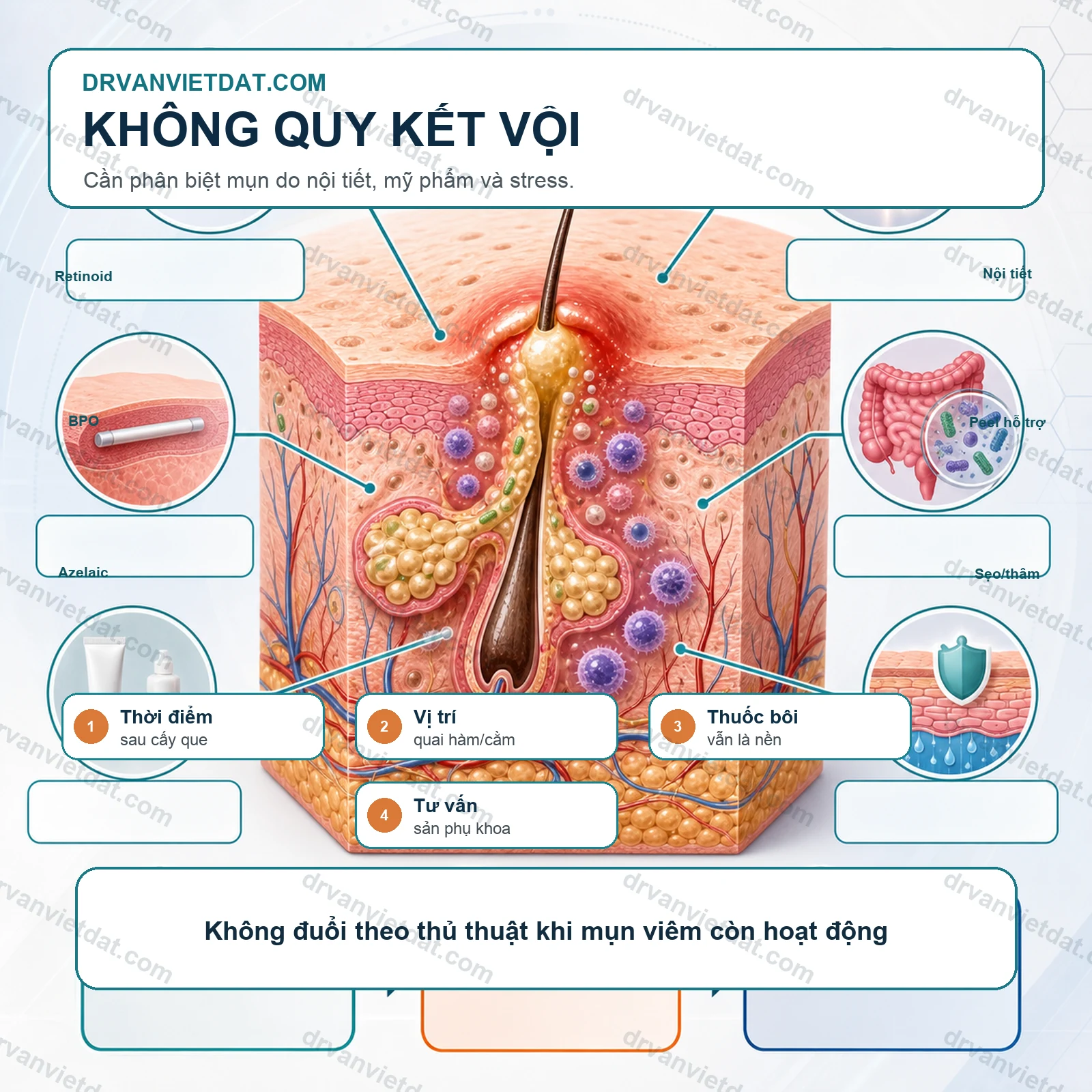 Cấy que tránh thai và mụn: vì sao da có thể thay đổi sau nội tiết?