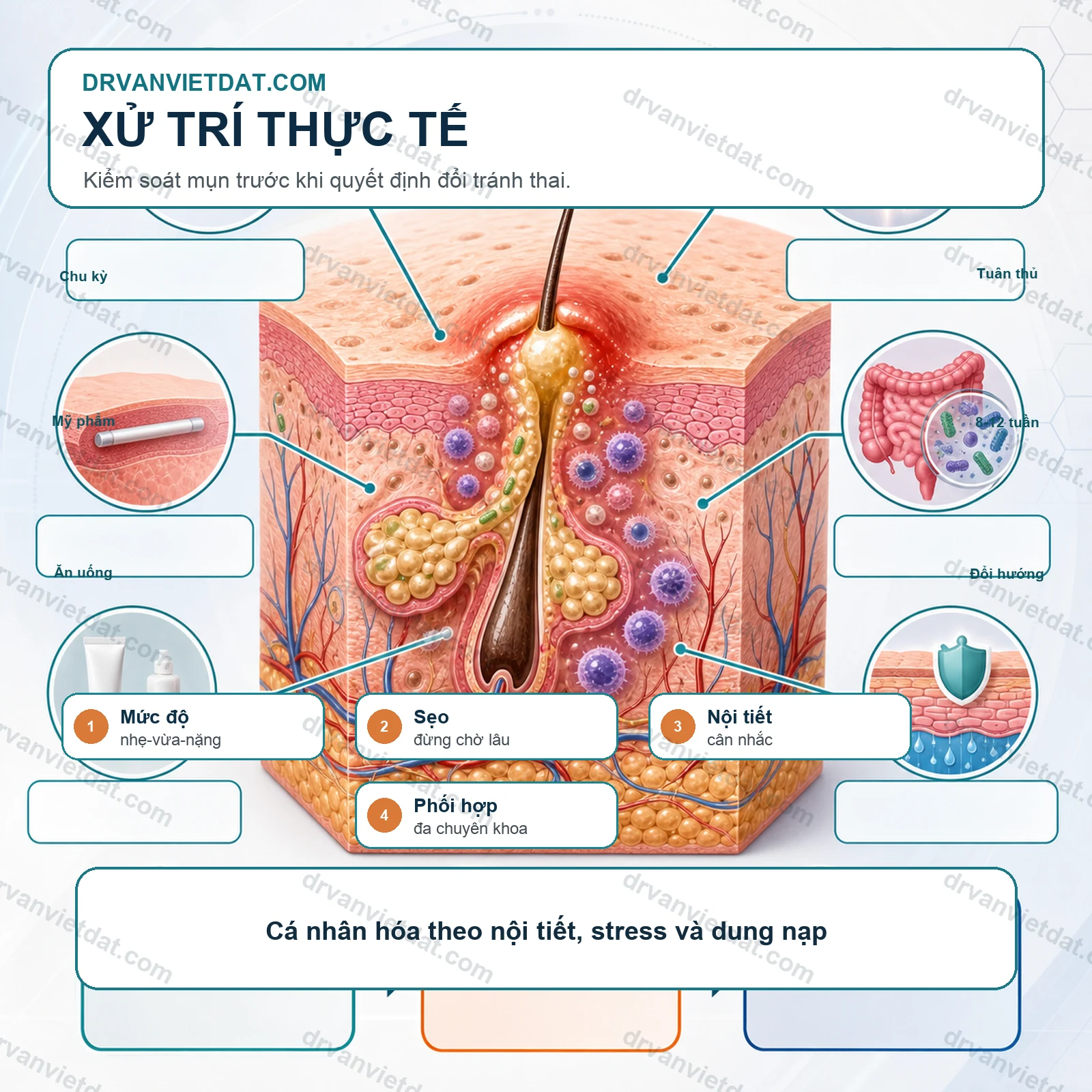 Cấy que tránh thai và mụn: vì sao da có thể thay đổi sau nội tiết?