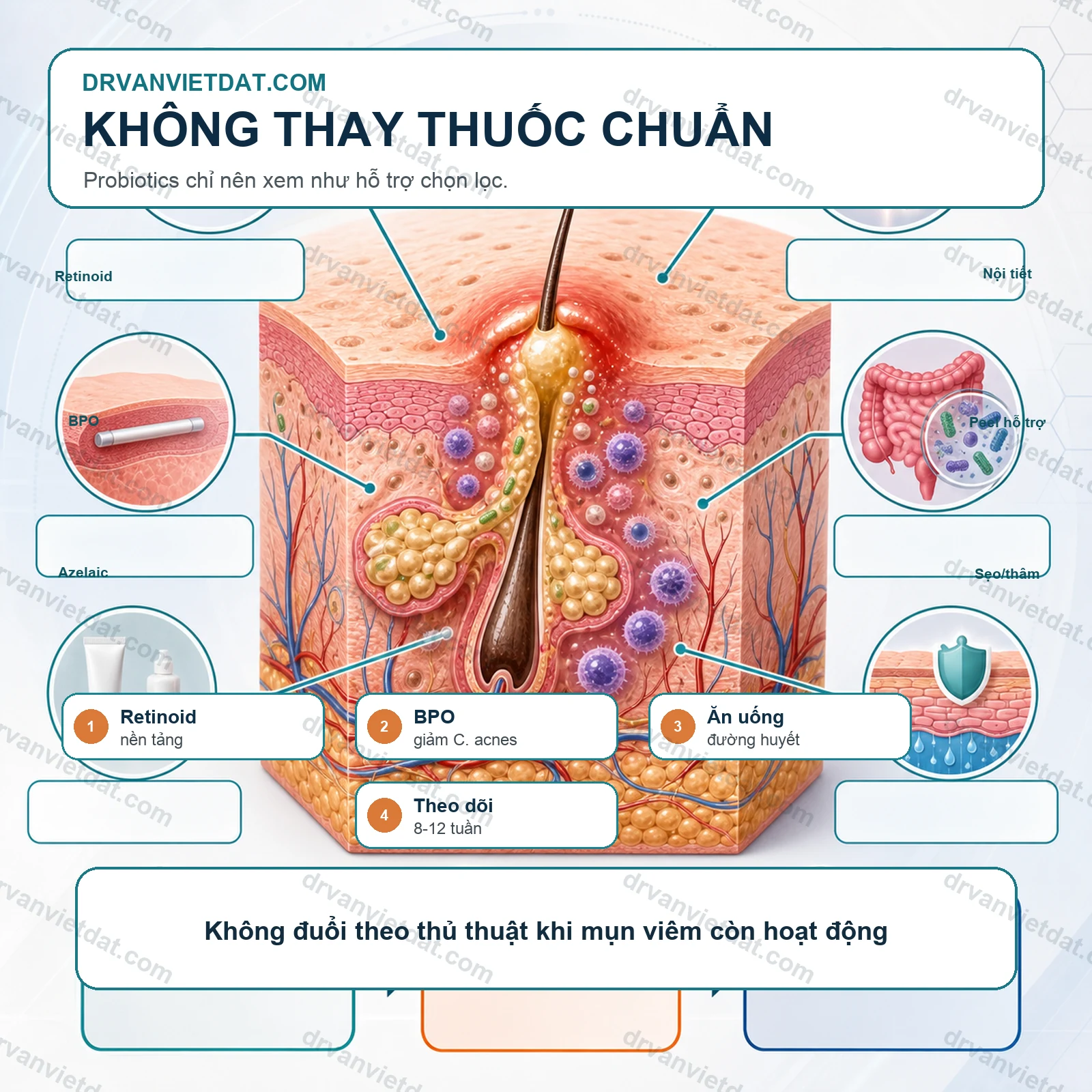 Probiotics trong mụn trứng cá: trục ruột-da có ý nghĩa thực hành không?