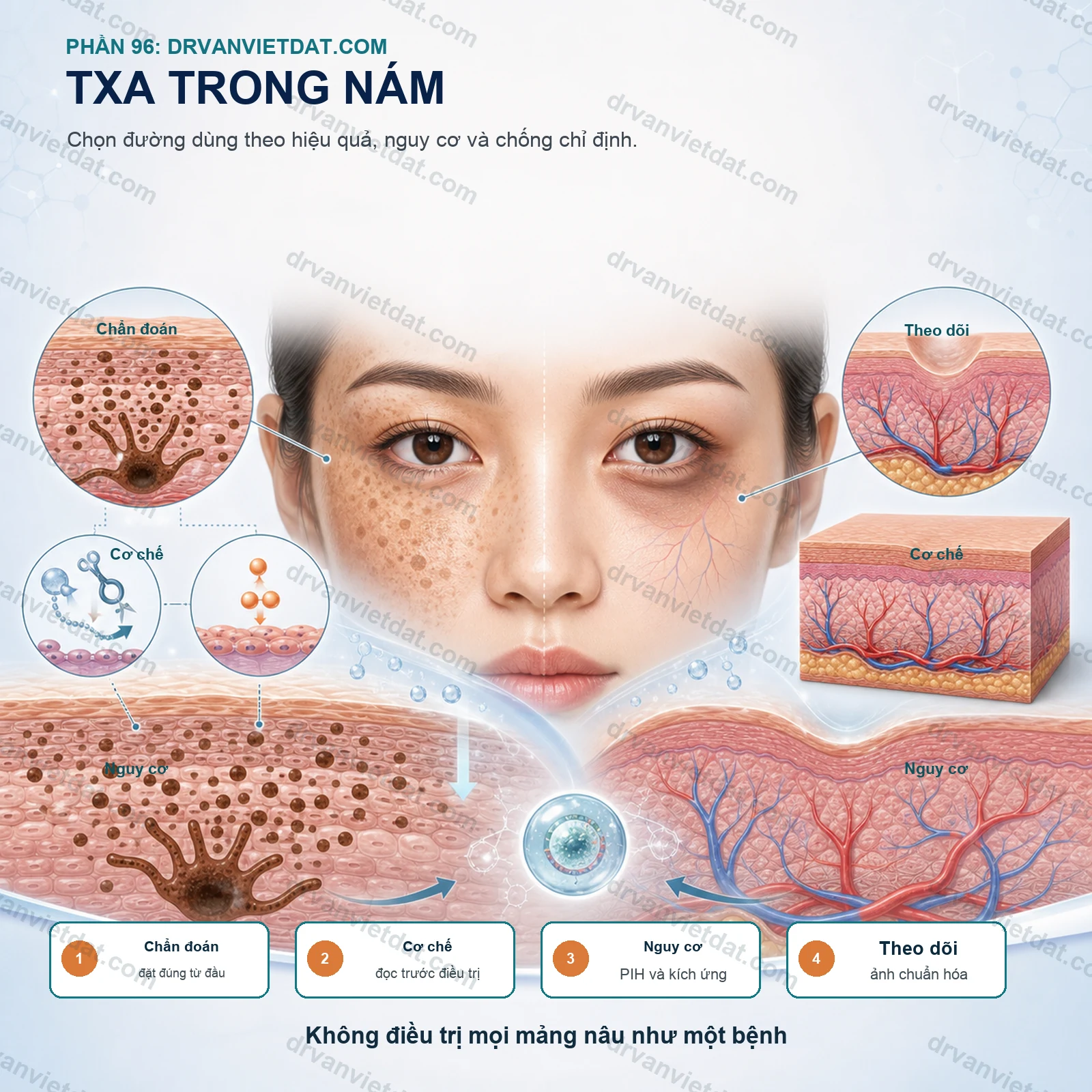 Phần 96: Tranexamic acid trong nám: thuốc bôi, đường uống và những điều cần thận trọng (phần nền tảng)