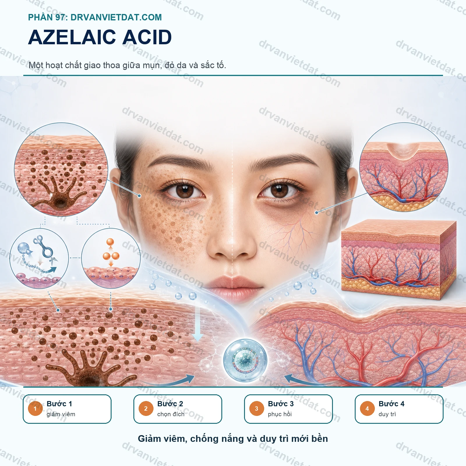 Phần 97: Azelaic acid: hoạt chất giao thoa giữa mụn, đỏ da và tăng sắc tố