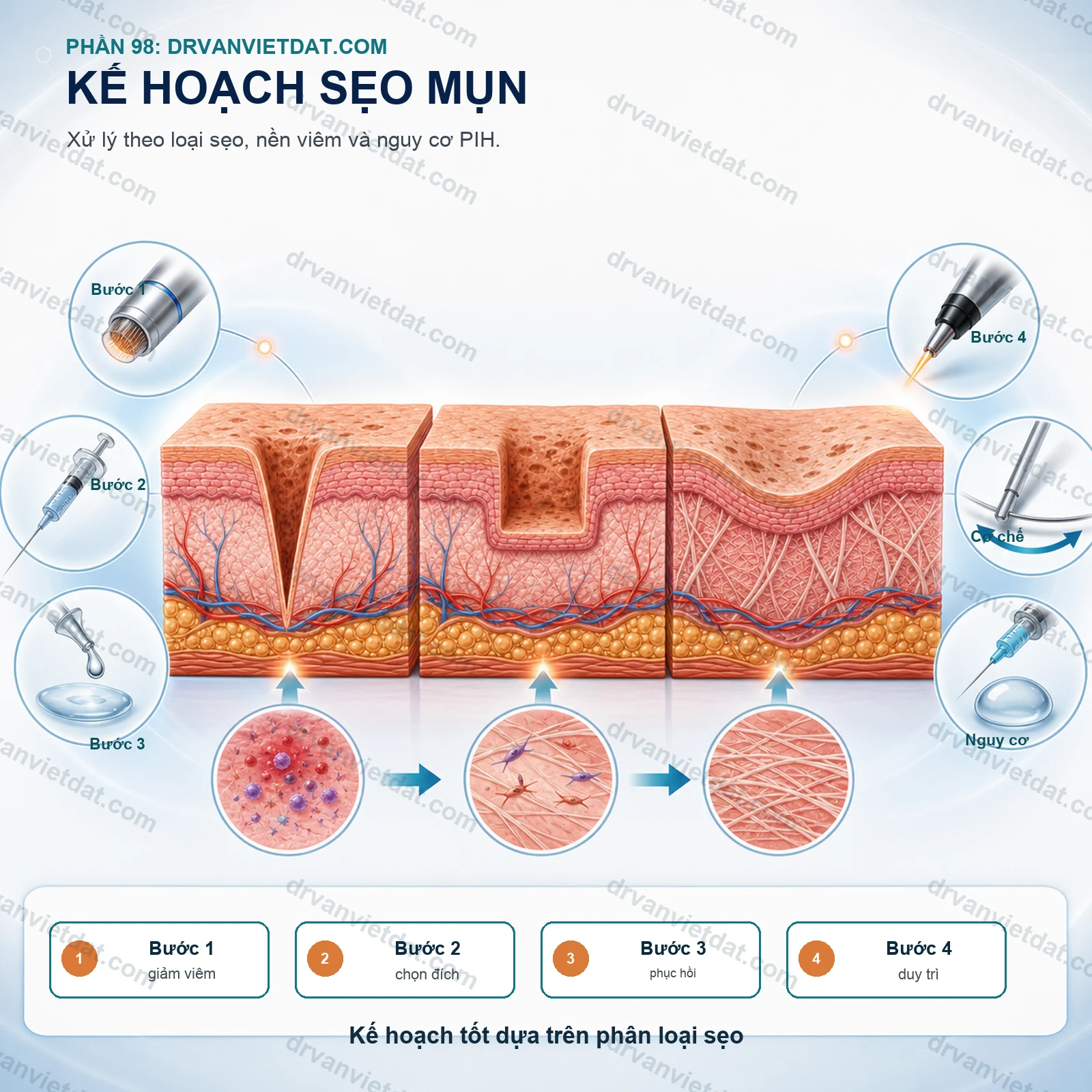 Phần 98: Sẹo mụn: cách xây dựng kế hoạch điều trị an toàn và có thứ tự