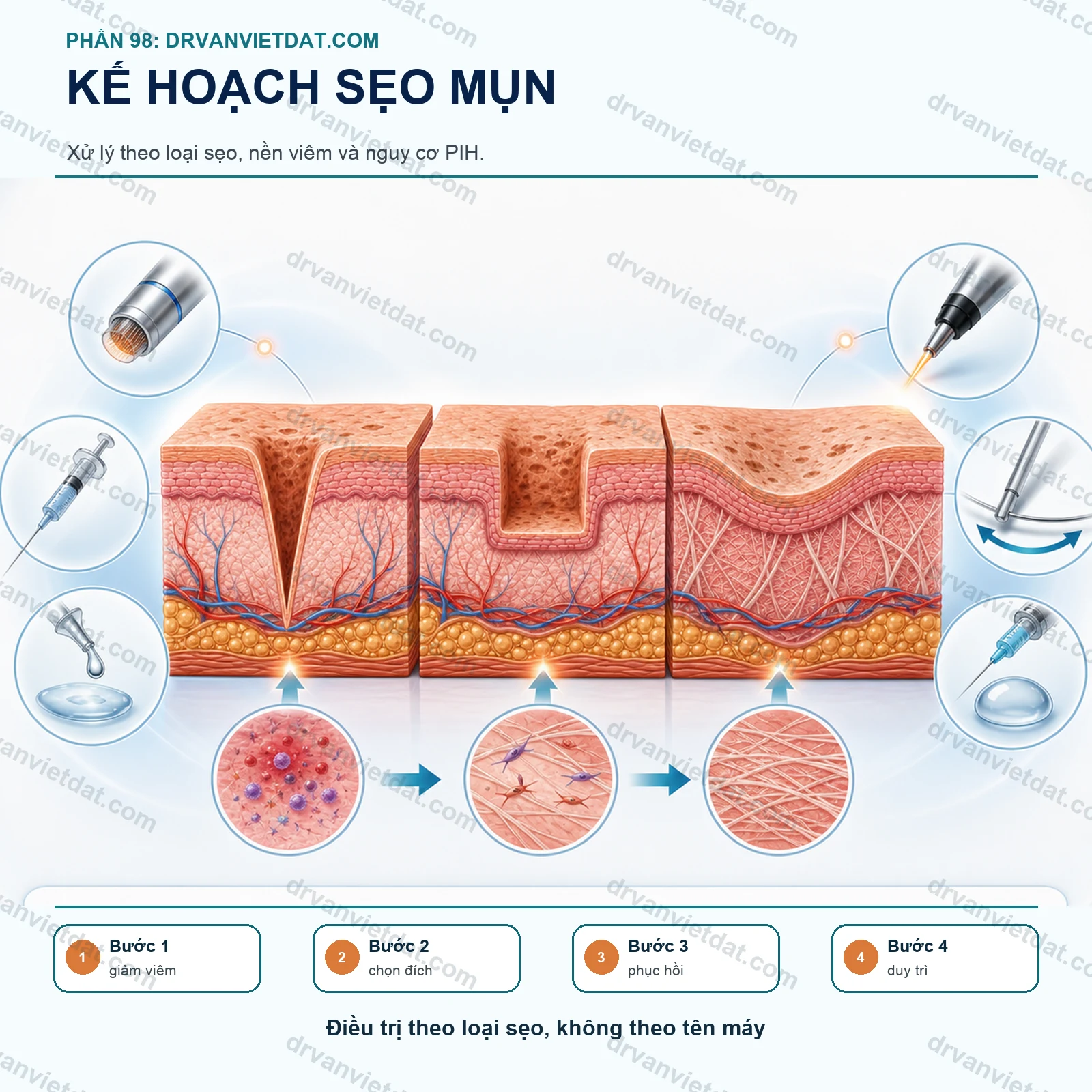 Phần 98: Sẹo mụn: cách xây dựng kế hoạch điều trị an toàn và có thứ tự