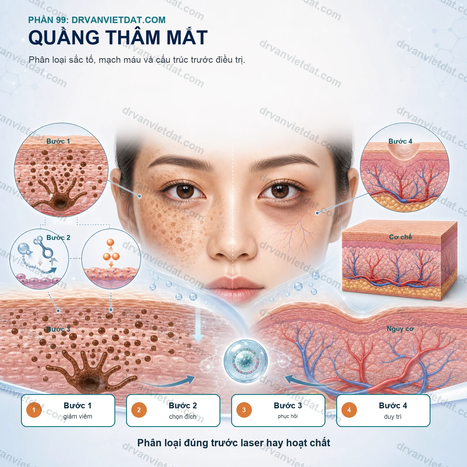 Phần 99: Quầng thâm mắt: phân loại sắc tố, mạch máu và cấu trúc trước điều trị