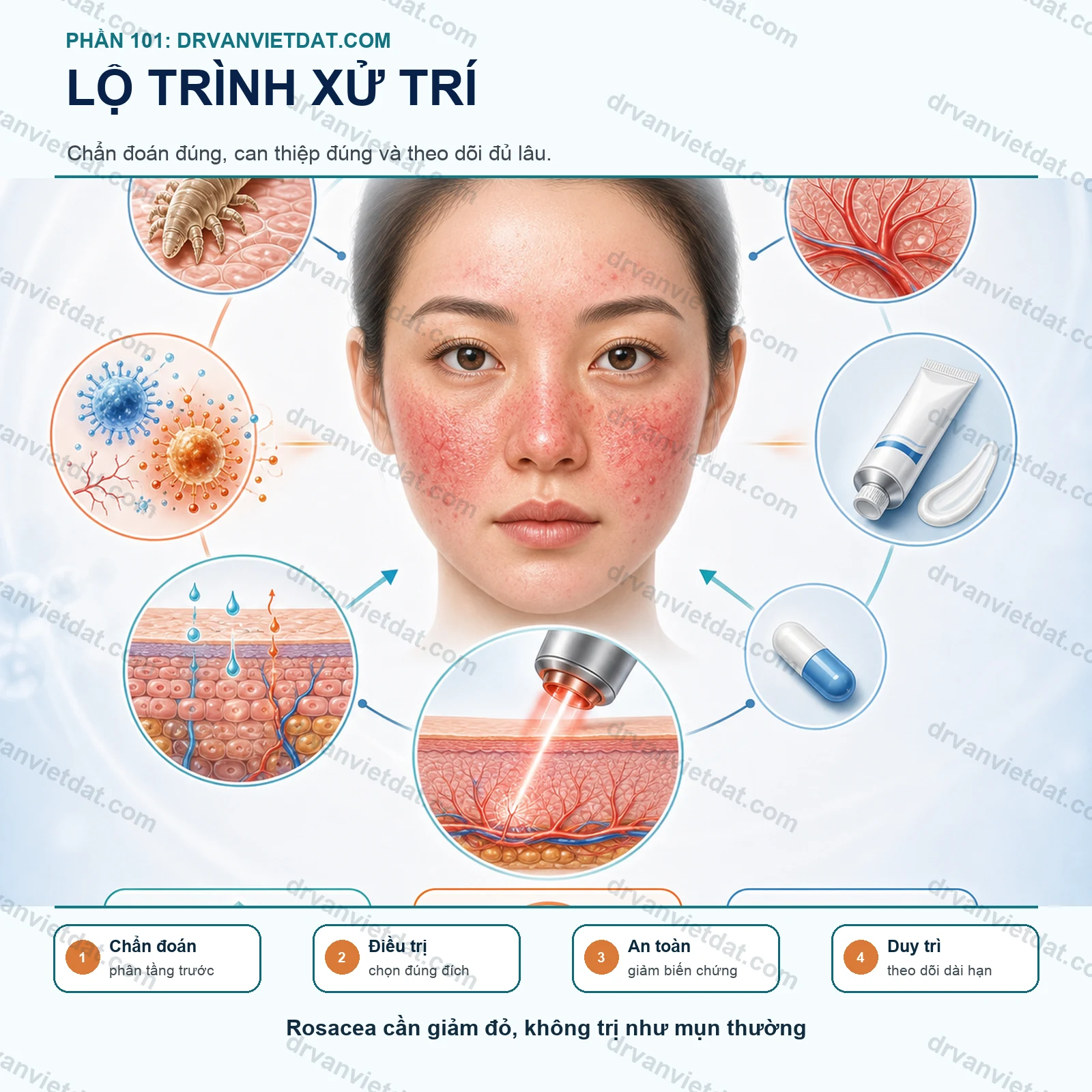 Phần 101: Trứng cá đỏ: điều trị đỏ da và sẩn viêm khác gì mụn thông thường?