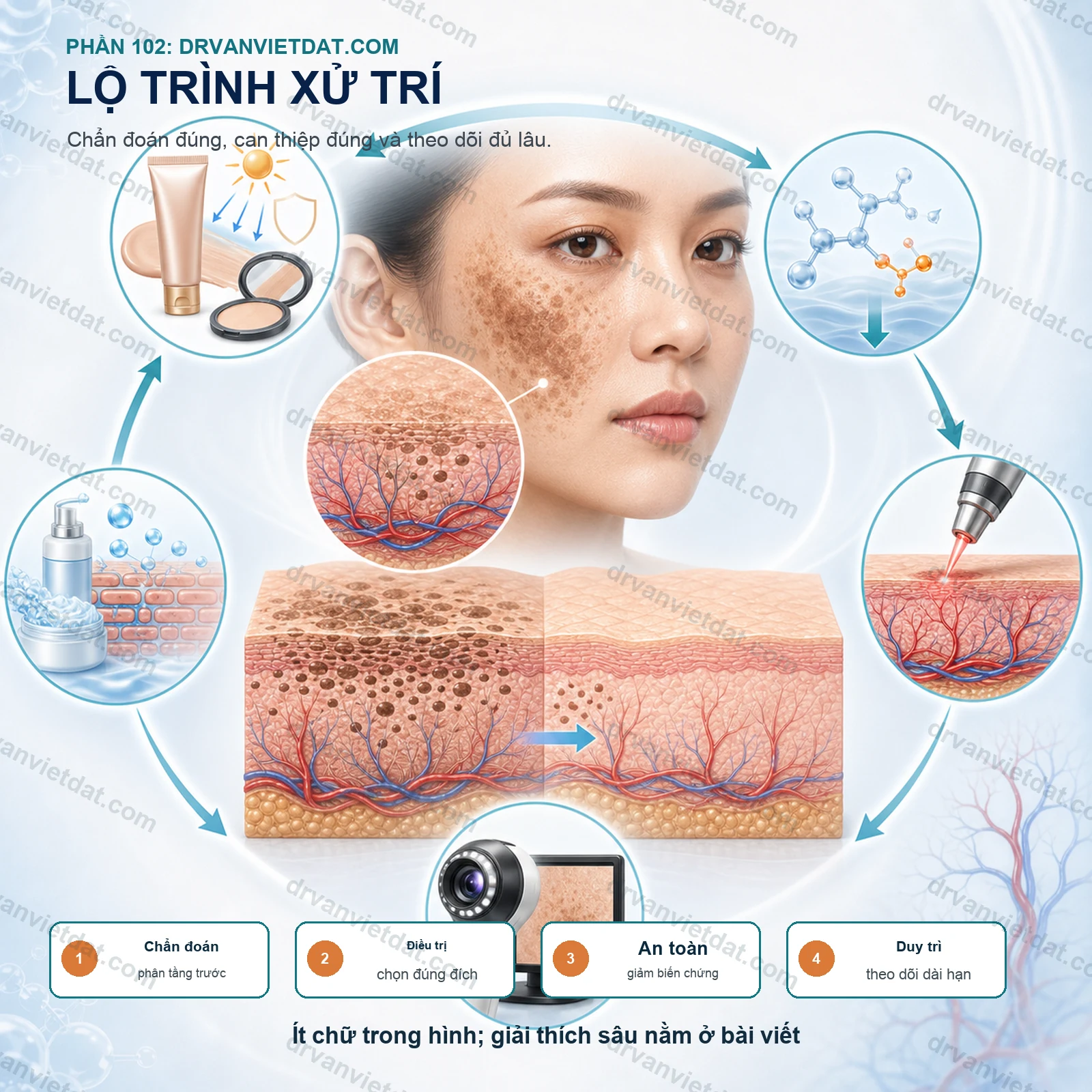Phần 102: Nám có yếu tố mạch máu: vì sao điều trị chỉ nhắm melanin là chưa đủ?