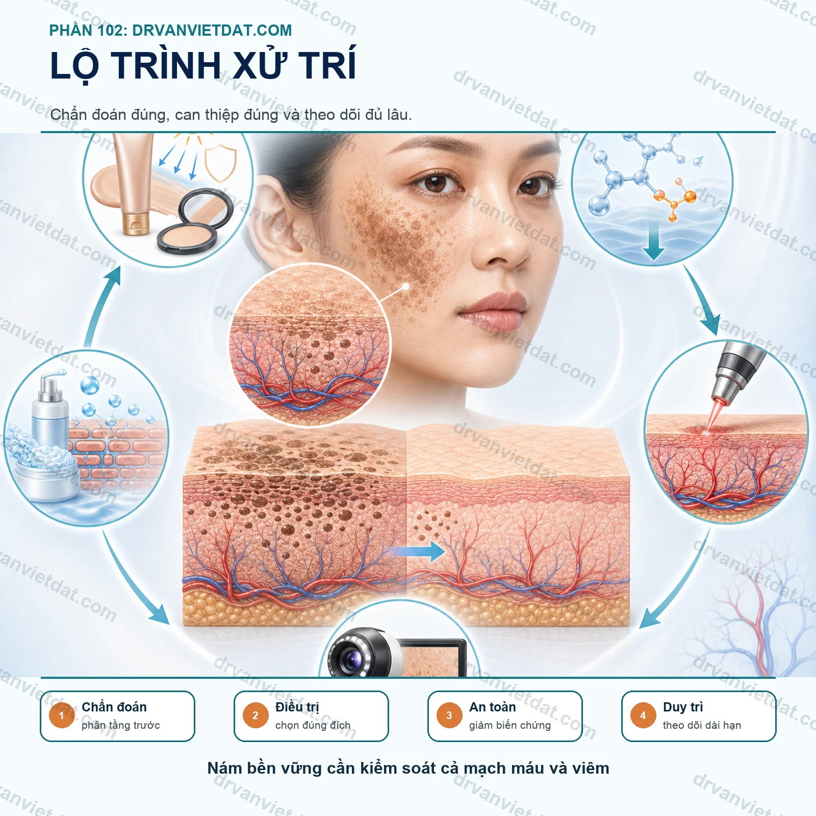 Phần 102: Nám có yếu tố mạch máu: vì sao điều trị chỉ nhắm melanin là chưa đủ?
