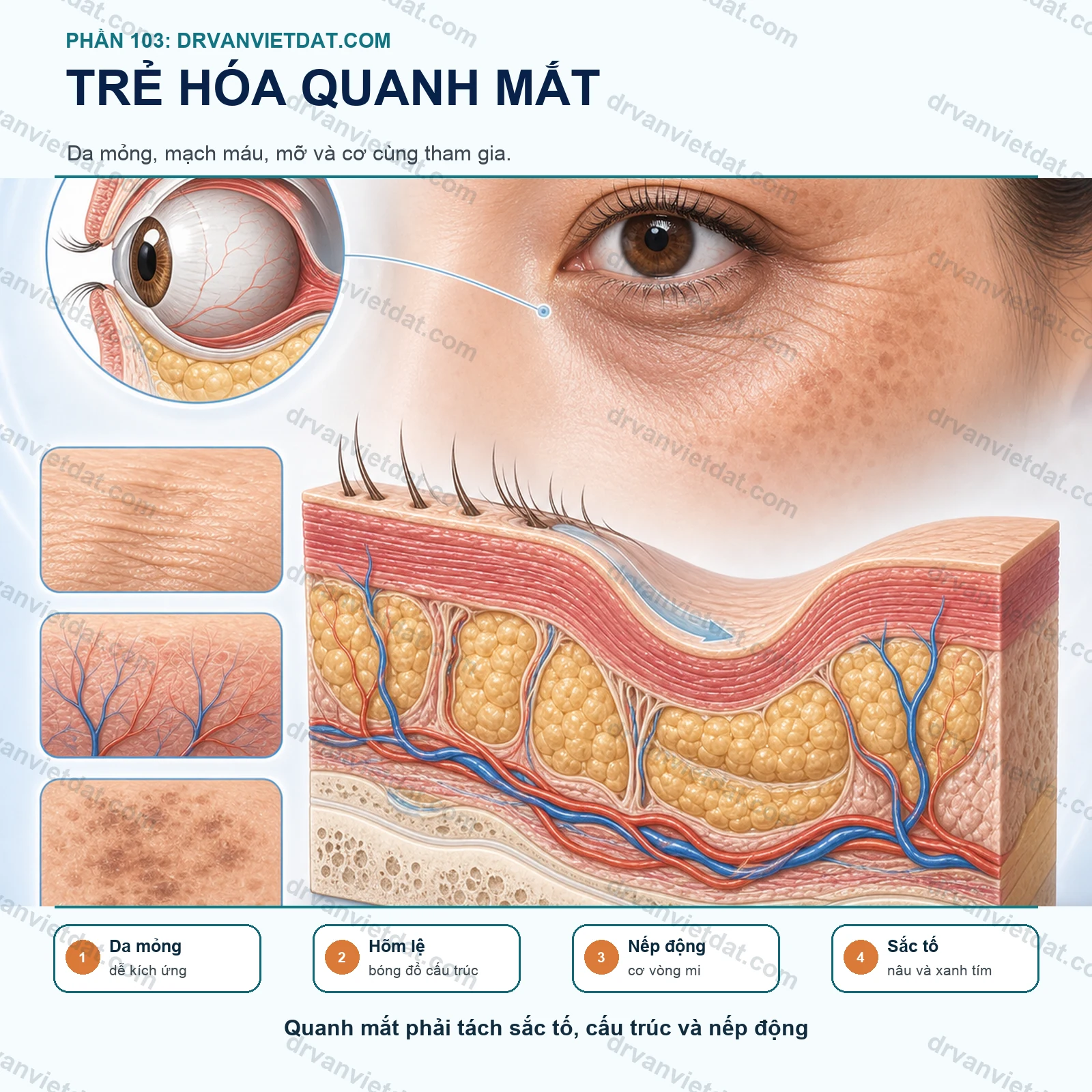 Phần 103: Trẻ hóa vùng quanh mắt: vì sao cần phối hợp nhiều phương pháp?