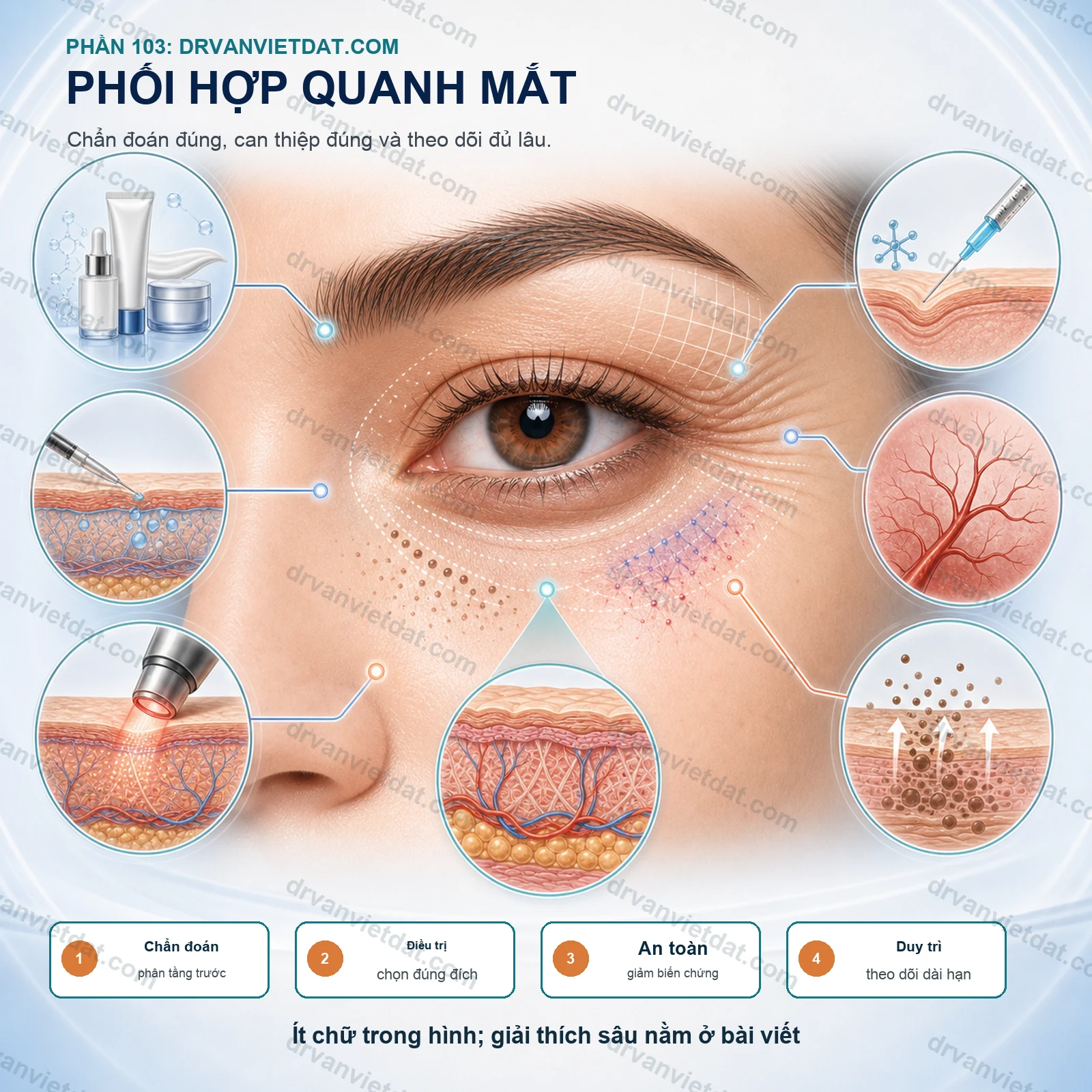 Phần 103: Trẻ hóa vùng quanh mắt: vì sao cần phối hợp nhiều phương pháp?