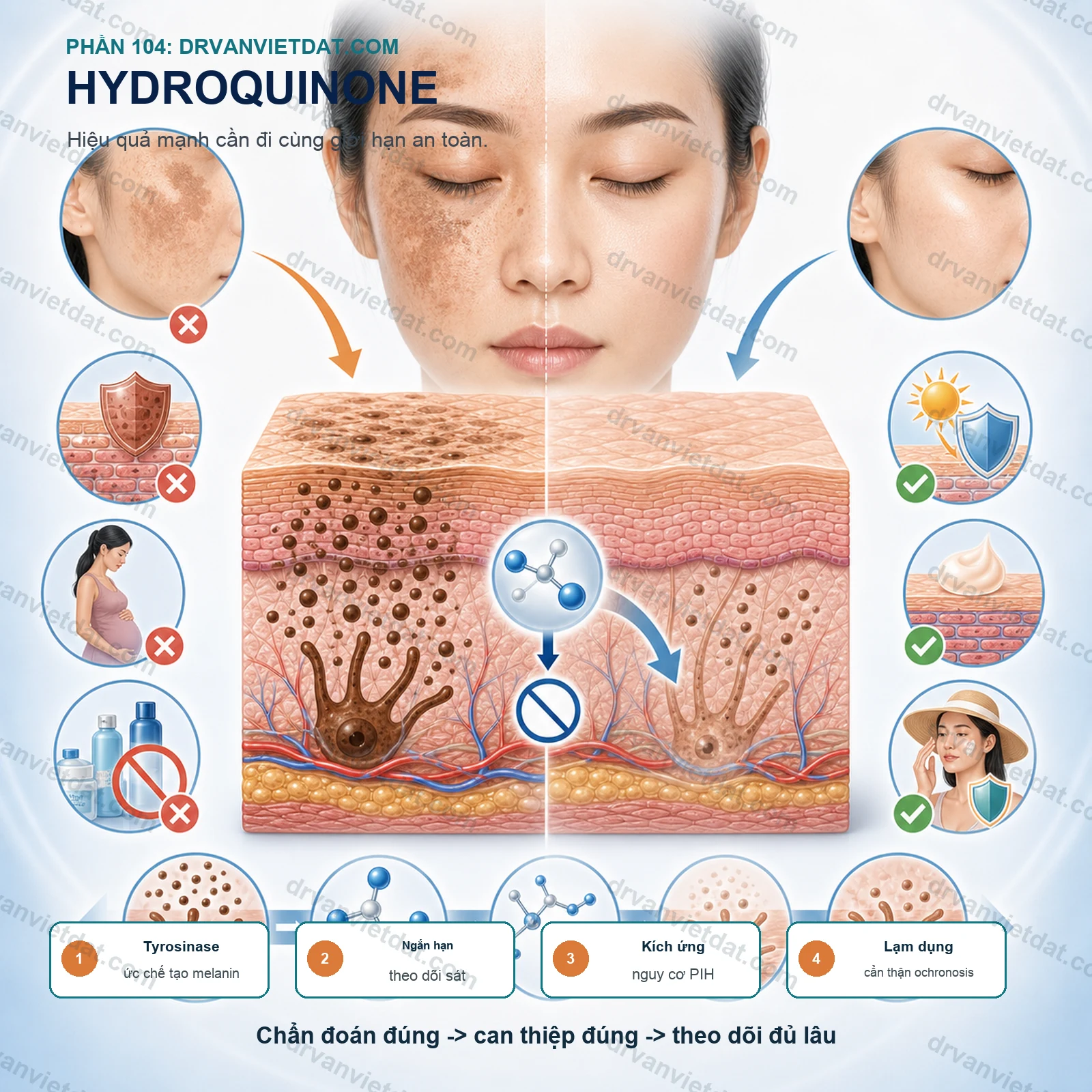 Phần 104: Hydroquinone trong điều trị nám: hiệu quả, cách dùng và nguy cơ khi lạm dụng (phần chọn bệnh nhân)