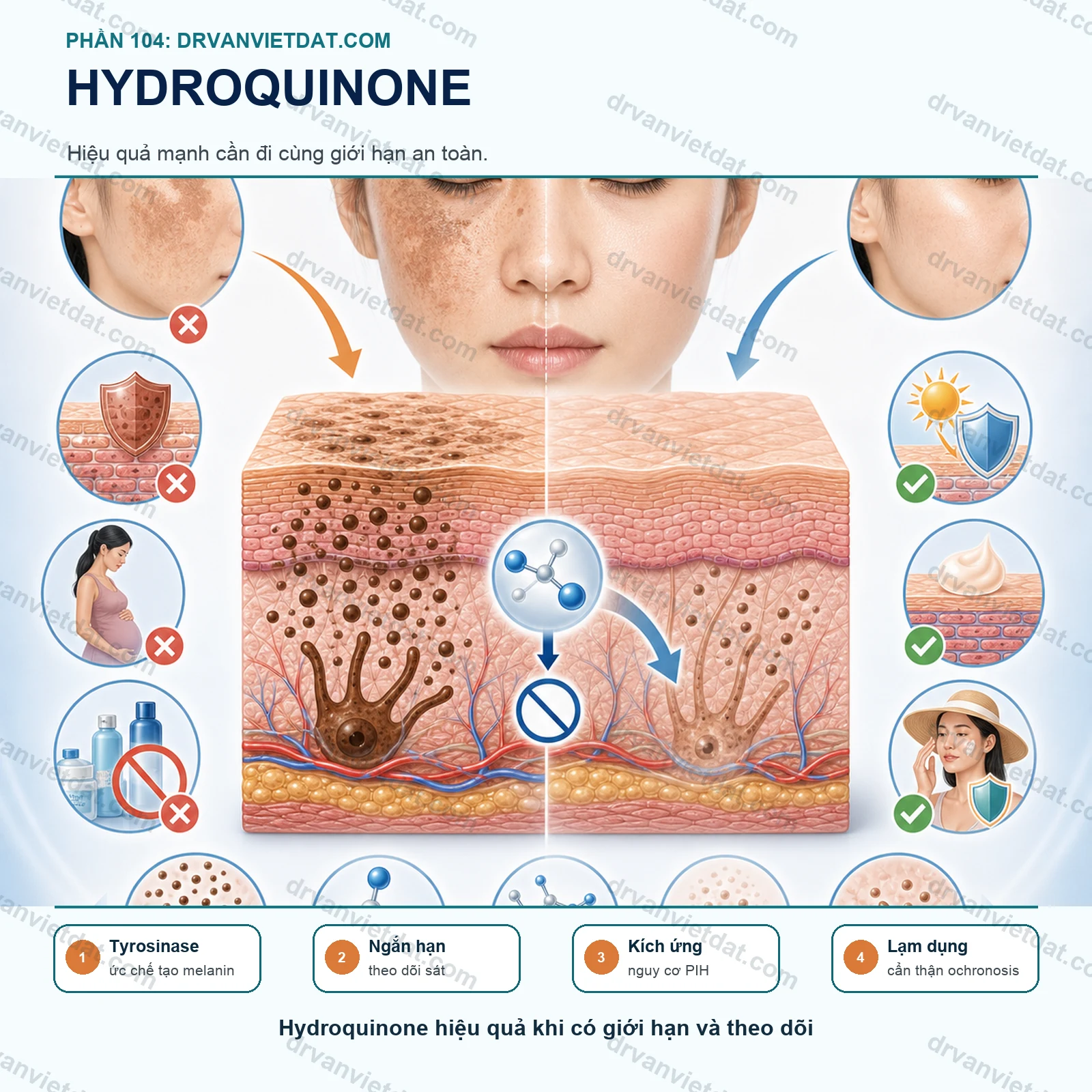 Phần 104: Hydroquinone trong điều trị nám: hiệu quả, cách dùng và nguy cơ khi lạm dụng (phần chọn bệnh nhân)