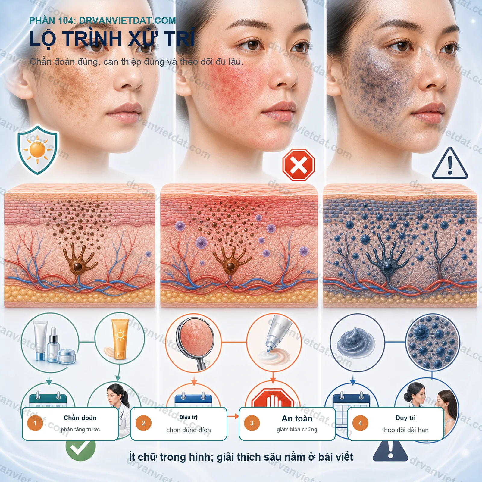 Phần 104: Hydroquinone trong điều trị nám: hiệu quả, cách dùng và nguy cơ khi lạm dụng (phần chọn bệnh nhân)