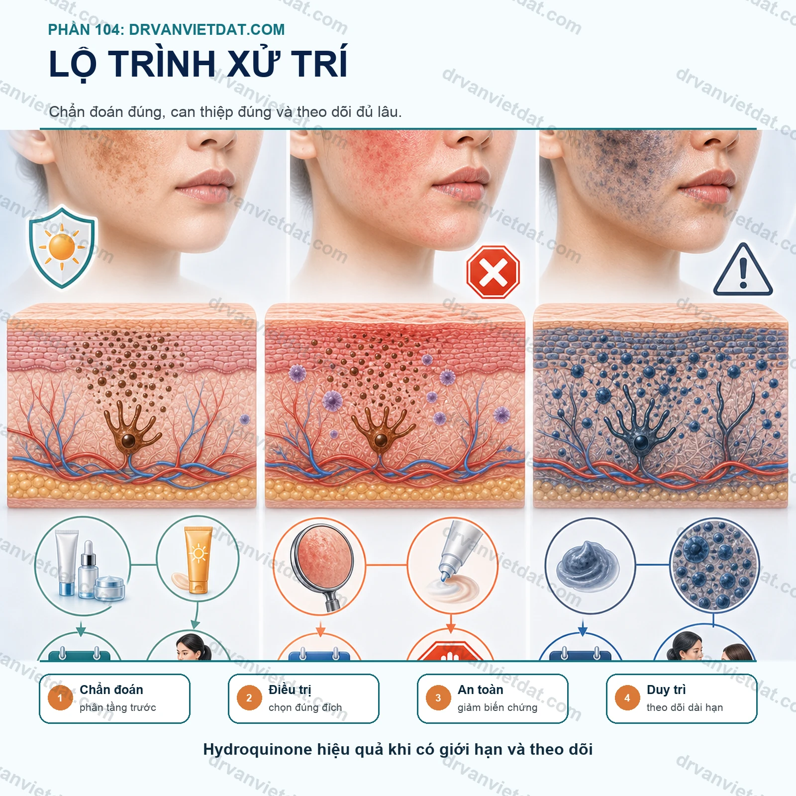 Phần 104: Hydroquinone trong điều trị nám: hiệu quả, cách dùng và nguy cơ khi lạm dụng (phần chọn bệnh nhân)