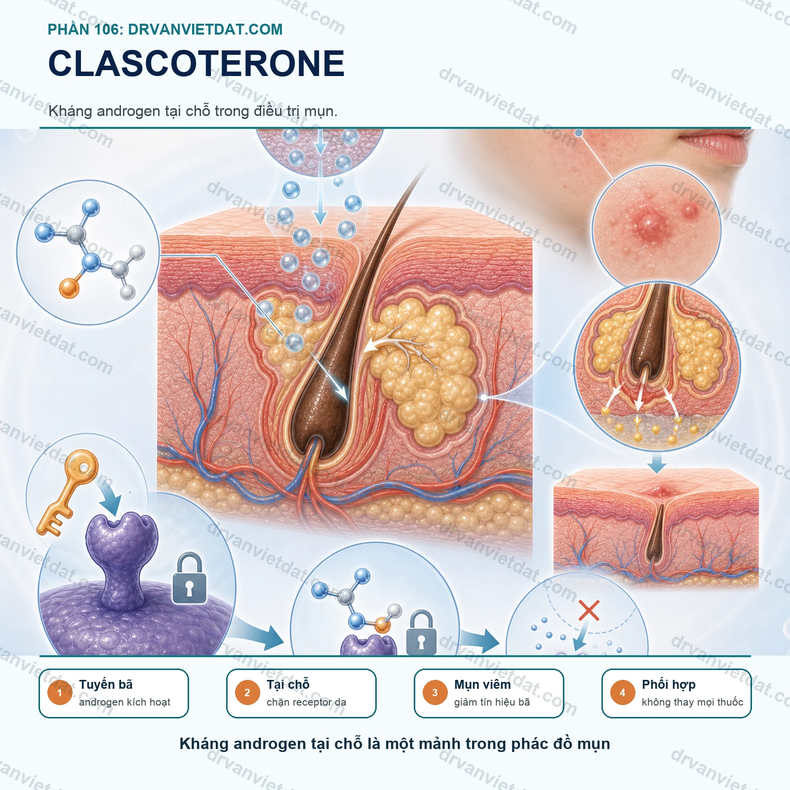 Phần 106: Clascoterone bôi trị mụn: kháng androgen tại chỗ có gì mới?