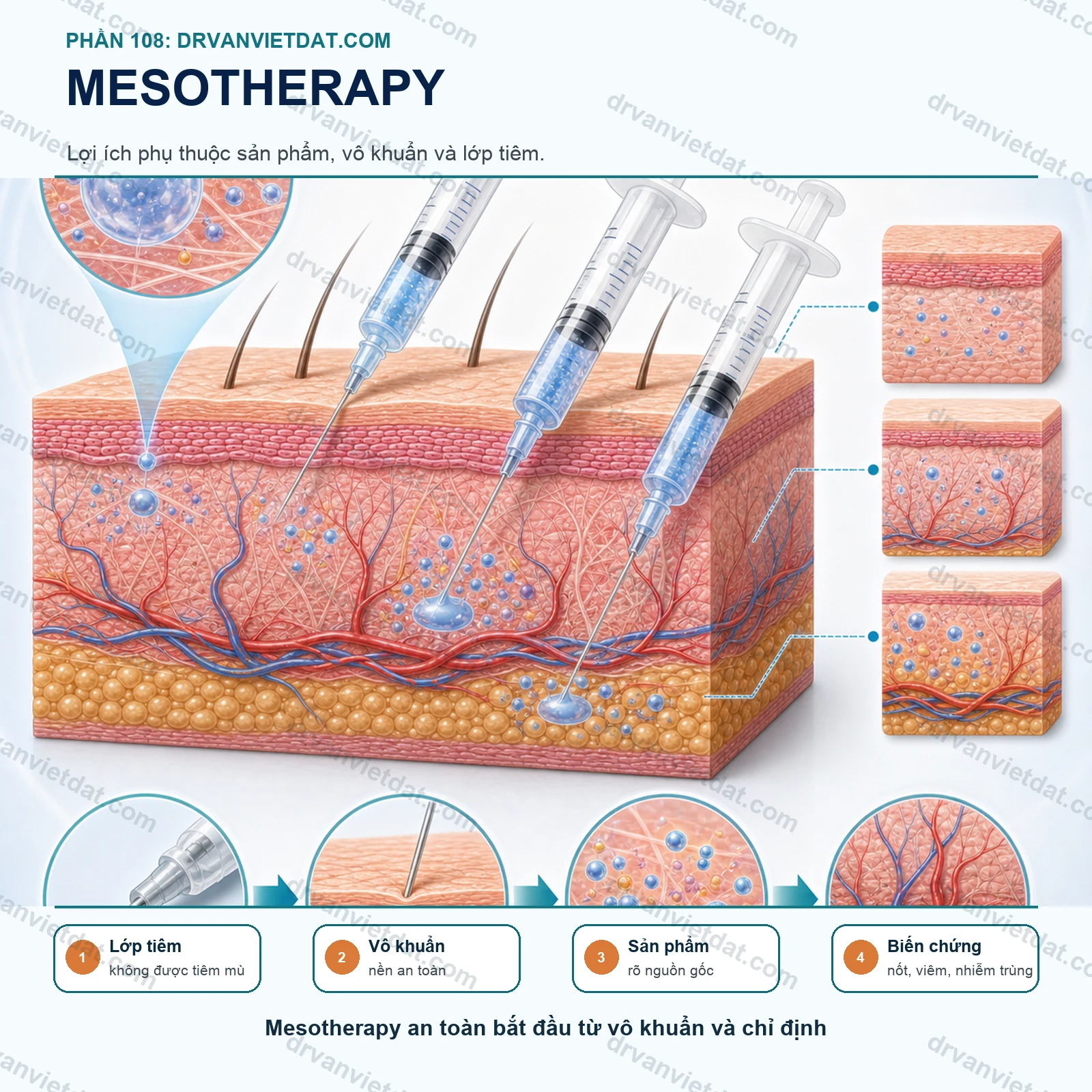 Phần 108: Mesotherapy: lợi ích, biến chứng và những nguyên tắc an toàn cần biết