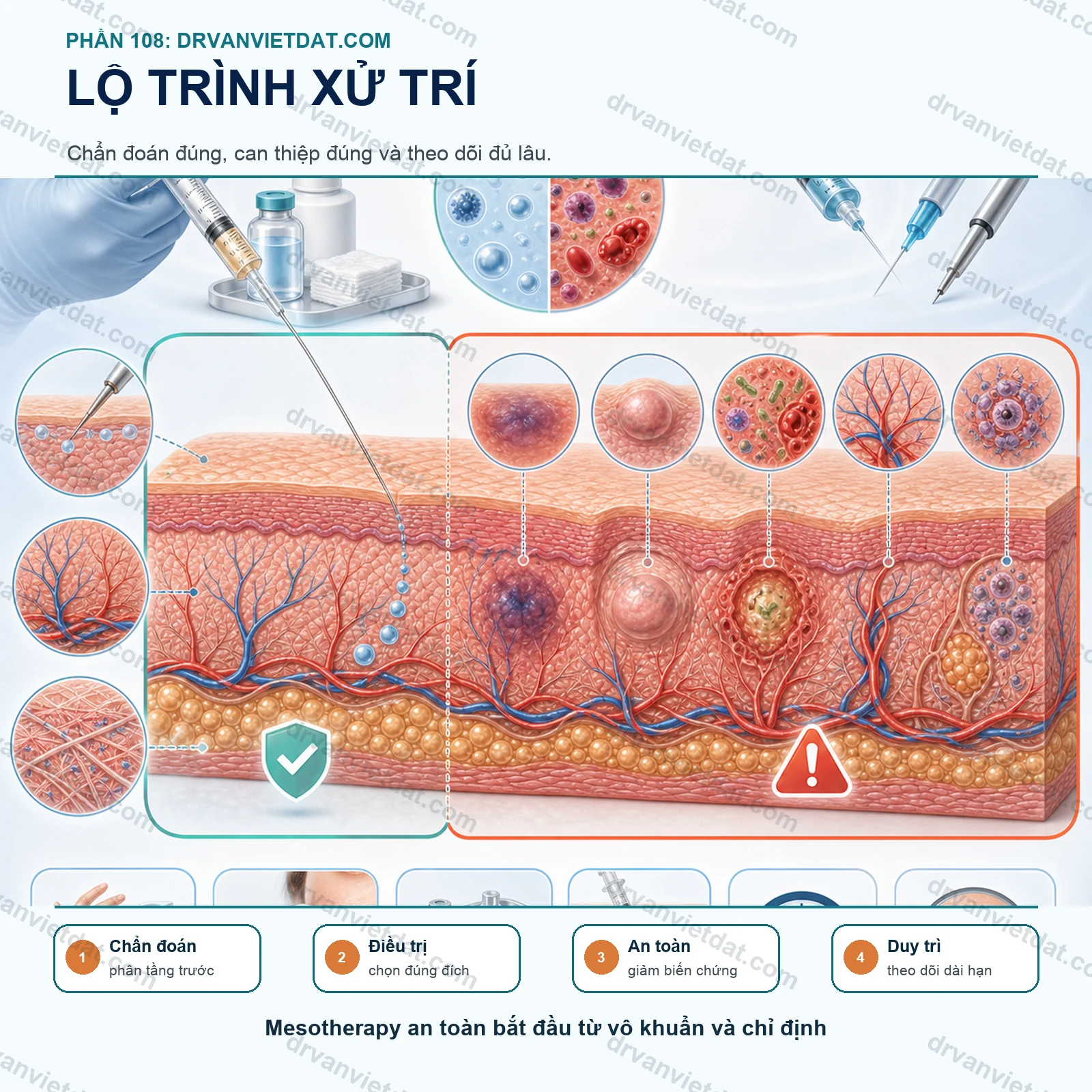 Phần 108: Mesotherapy: lợi ích, biến chứng và những nguyên tắc an toàn cần biết