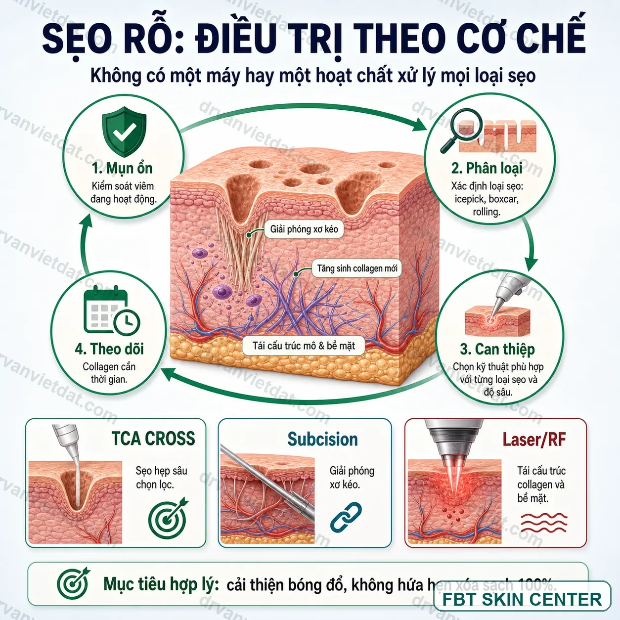 Bản đồ chọn thiết bị theo sẹo