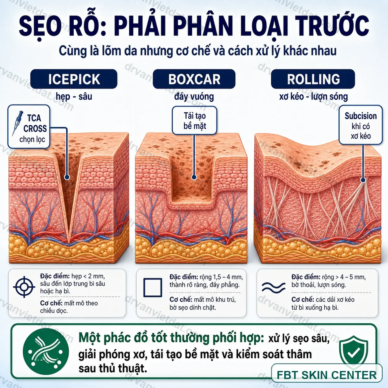 Phân loại sẹo mụn teo
