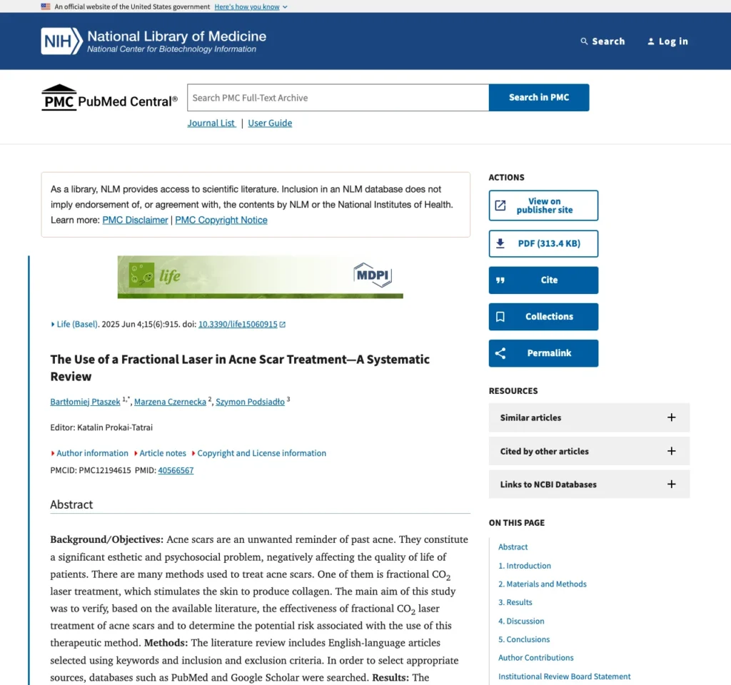 Screenshot nguồn: bài systematic review trên PMC về fractional laser trong điều trị sẹo mụn.