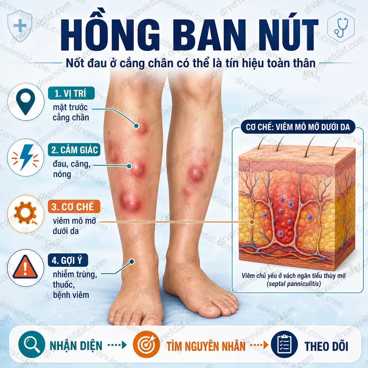 135-hong-ban-nut-nhan-dien