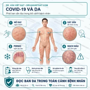 Phần 133: Biểu hiện ngoài da liên quan COVID-19: khi nào chỉ theo dõi, khi nào cần khám? - thumbnail
