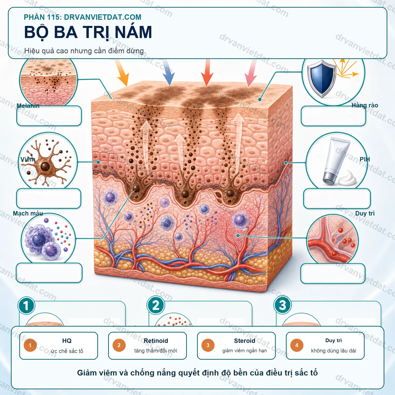 Công thức bộ ba trong nám: hiệu quả cao nhưng không phải kem dùng lâu dài