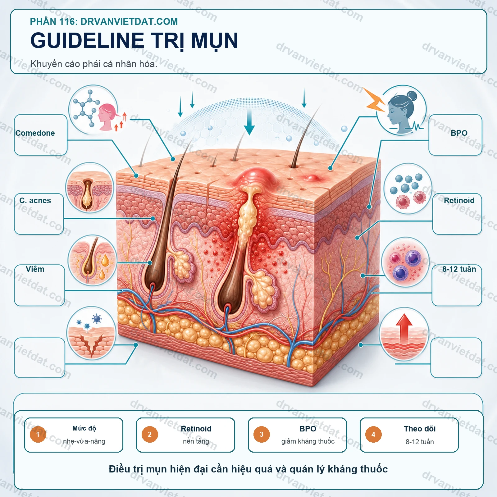 Điều trị mụn theo guideline: cách đọc khuyến cáo để áp dụng cho từng người