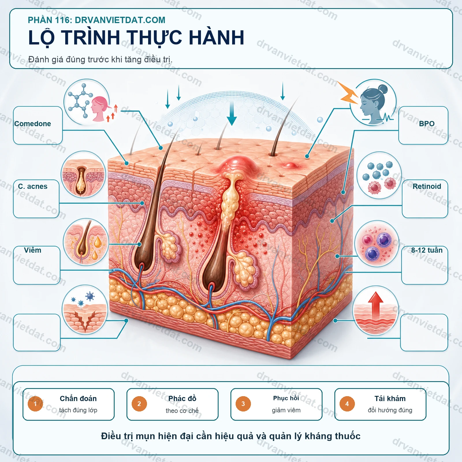 Điều trị mụn theo guideline: cách đọc khuyến cáo để áp dụng cho từng người
