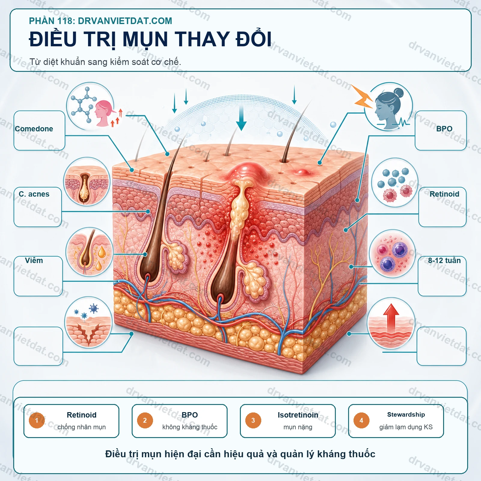 Điều trị mụn đã thay đổi thế nào trong vài thập kỷ qua?